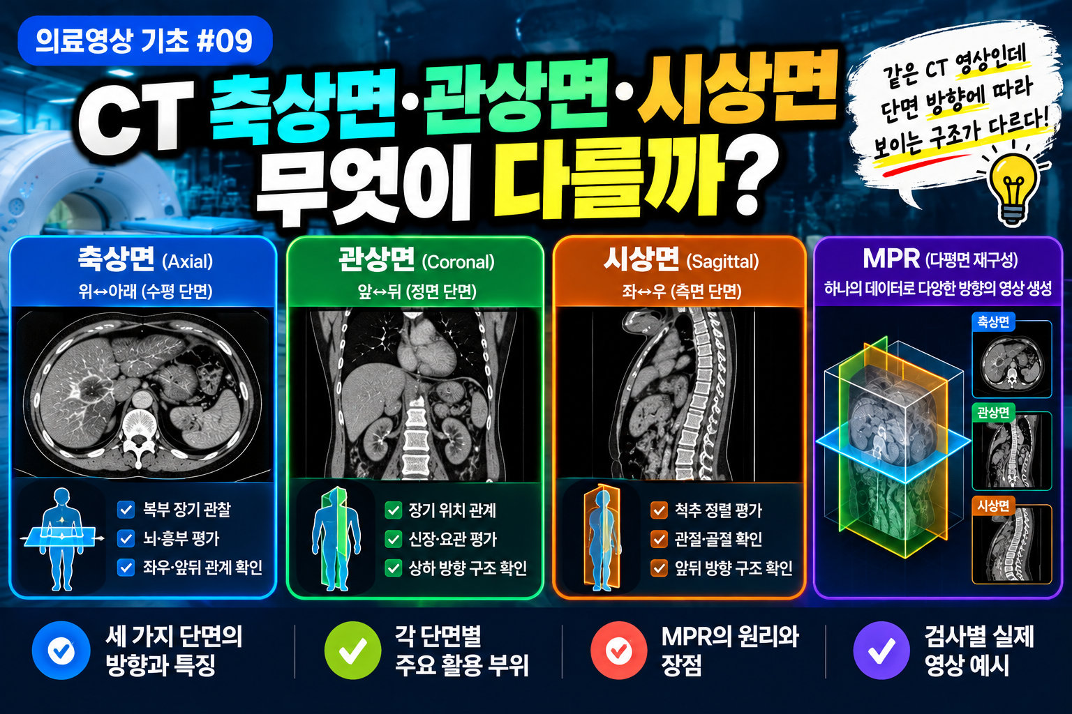 CT 단면 방향 썸네일