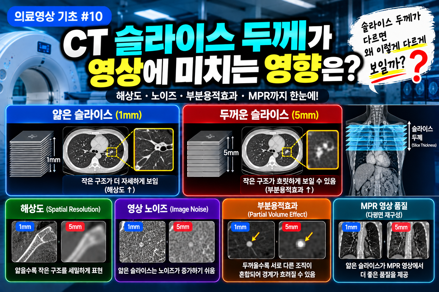 CT 슬라이스 두께 썸네일