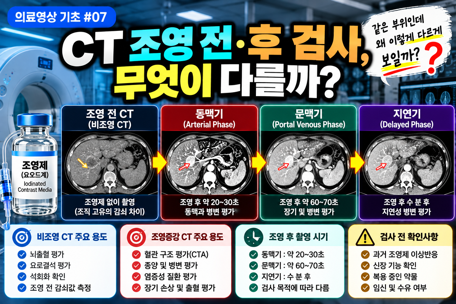 CT 조영 전후 썸네일